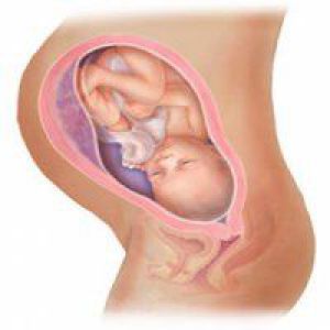 35 Неделя беременности: тазовое предлежание